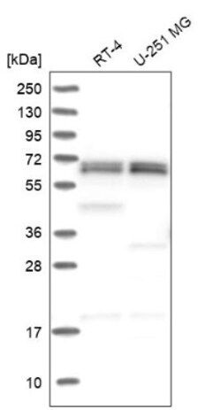 EDC3 Antibody, Novus Biologicals 25ul | Buy Online | Novus Biologicals | Fisher Scientific